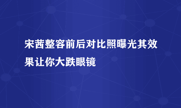 宋茜整容前后对比照曝光其效果让你大跌眼镜