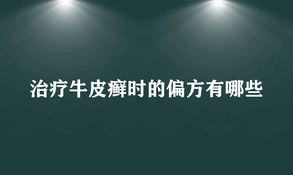 治疗牛皮癣时的偏方有哪些