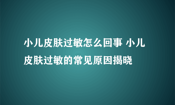 小儿皮肤过敏怎么回事 小儿皮肤过敏的常见原因揭晓