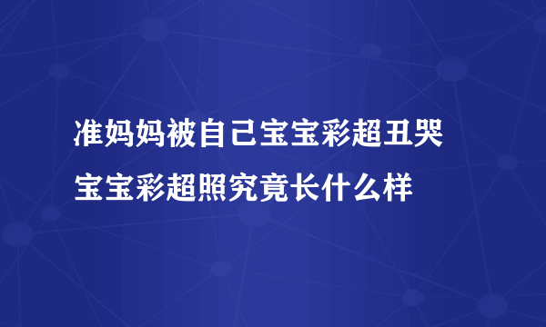 准妈妈被自己宝宝彩超丑哭 宝宝彩超照究竟长什么样