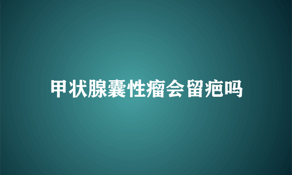 甲状腺囊性瘤会留疤吗