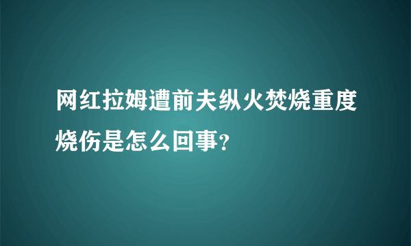 网红拉姆遭前夫纵火焚烧重度烧伤是怎么回事？