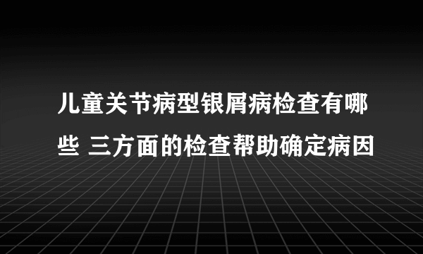 儿童关节病型银屑病检查有哪些 三方面的检查帮助确定病因