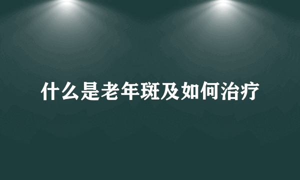 什么是老年斑及如何治疗